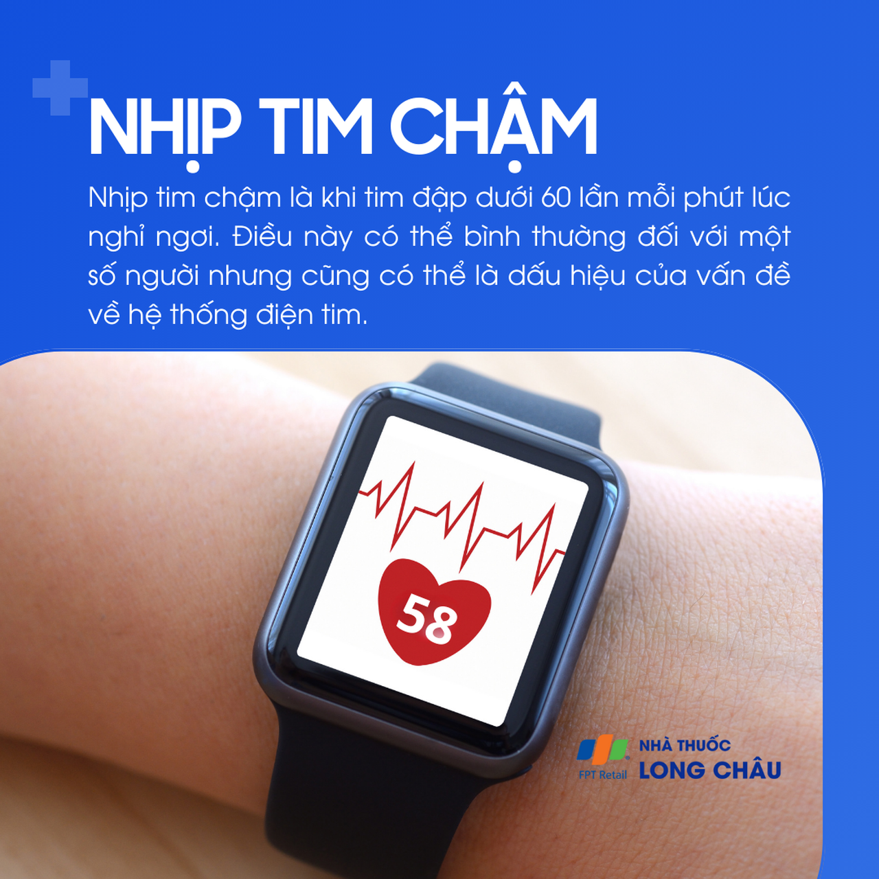 Nhịp tim chậm 1
