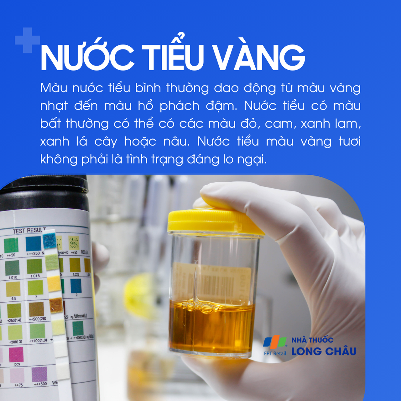 Nước tiểu vàng 1
