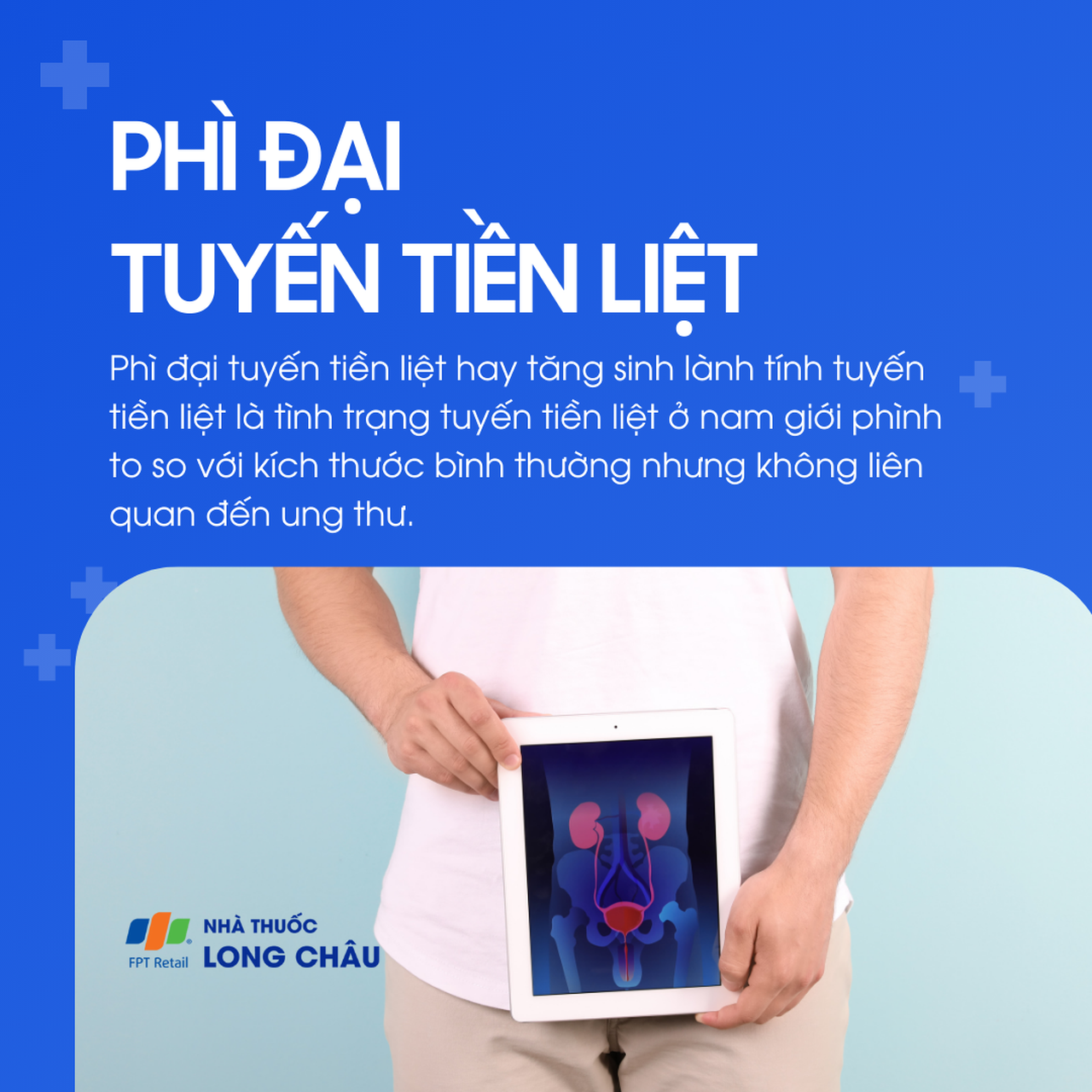 Phì đại tuyến tiền liệt 1