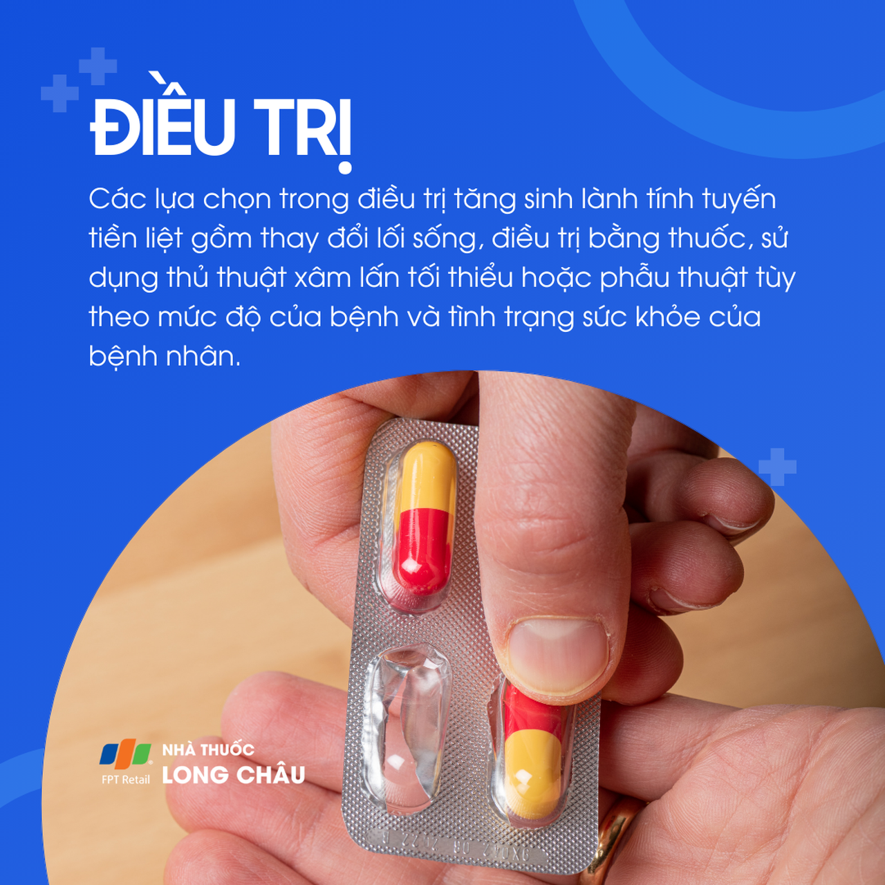 Phì đại tuyến tiền liệt 6