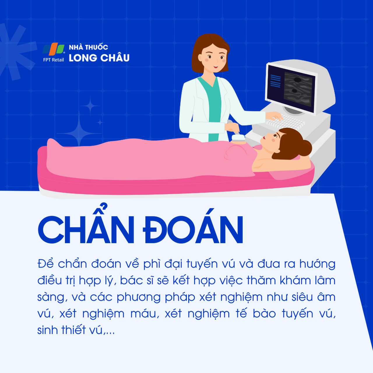 Phì đại tuyến vú 5