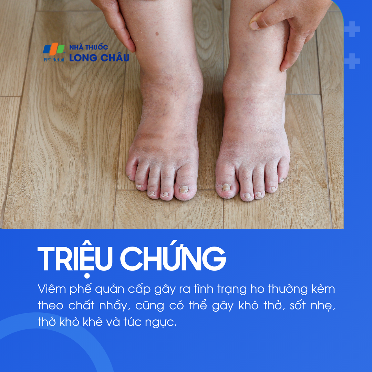 Phù bạch huyết 2