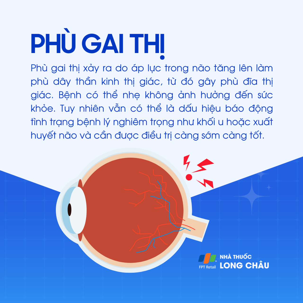 Phù gai thị 1
