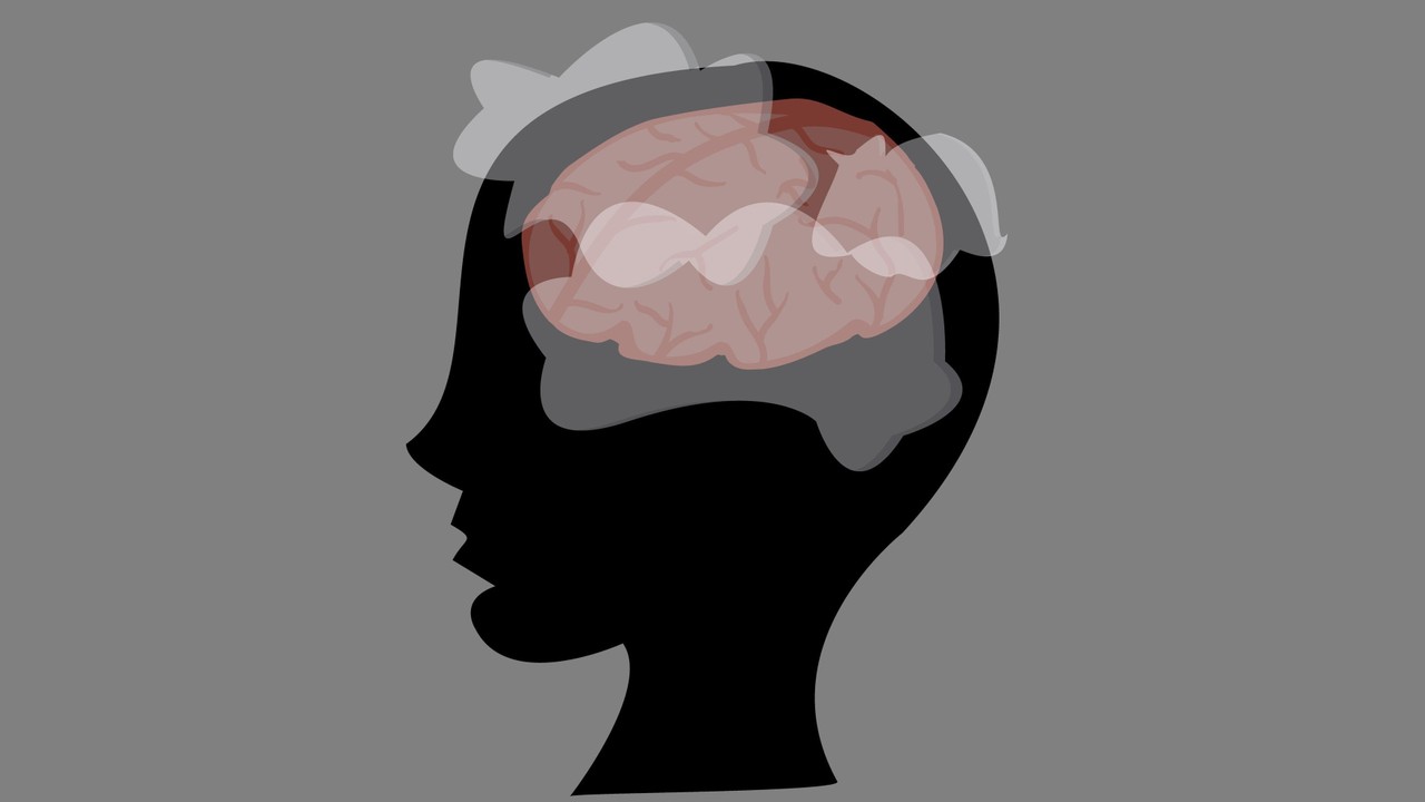 Rối loạn chức năng não sau hóa trị: Nguyên nhân, triệu chứng và phương pháp điều trị 1