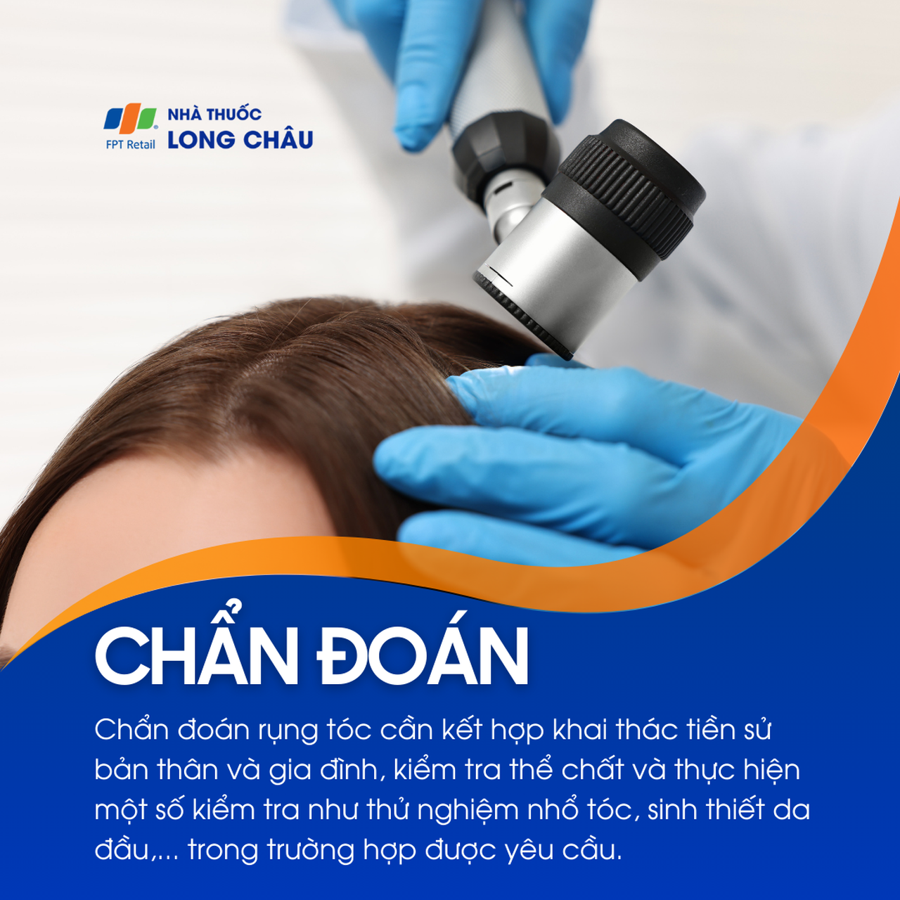 Rụng tóc 5