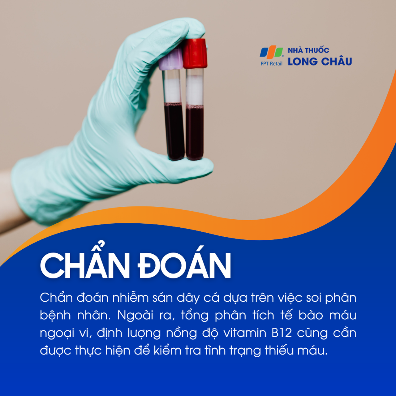 Nhiễm sán dây cá 5