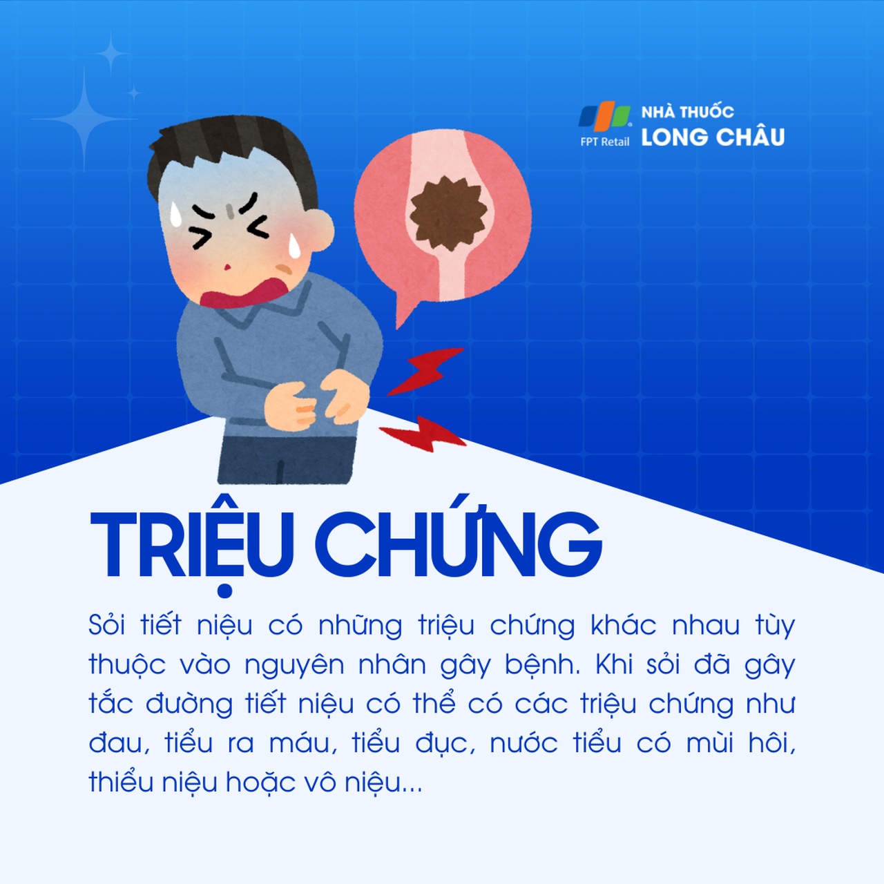 Sỏi niệu 2