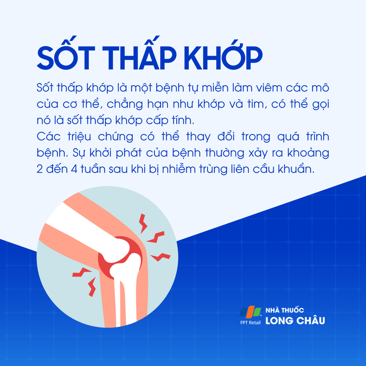 Sốt thấp khớp 1