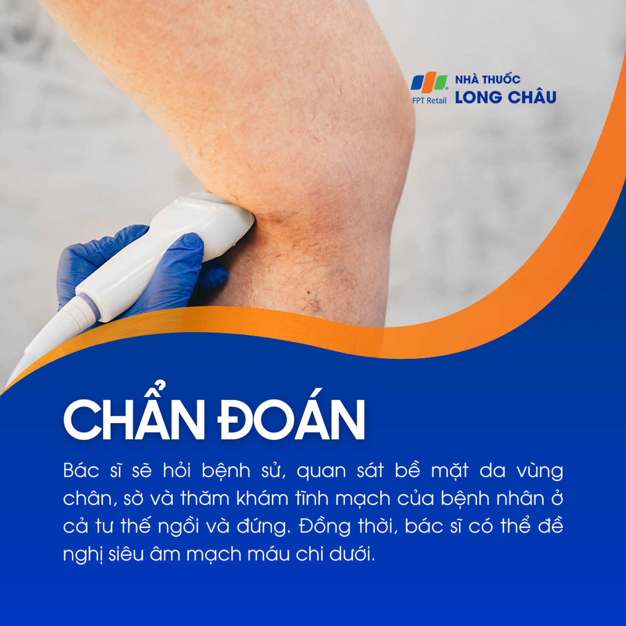 Suy giãn tĩnh mạch sâu chi dưới 5