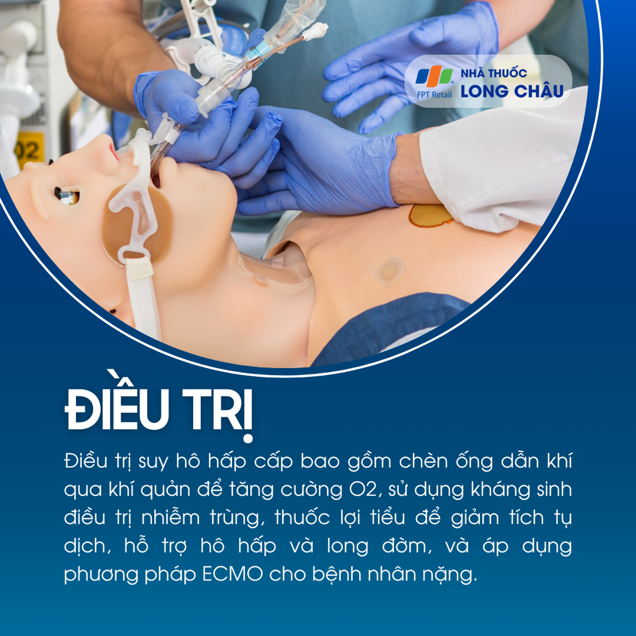 Suy hô hấp cấp tính 6