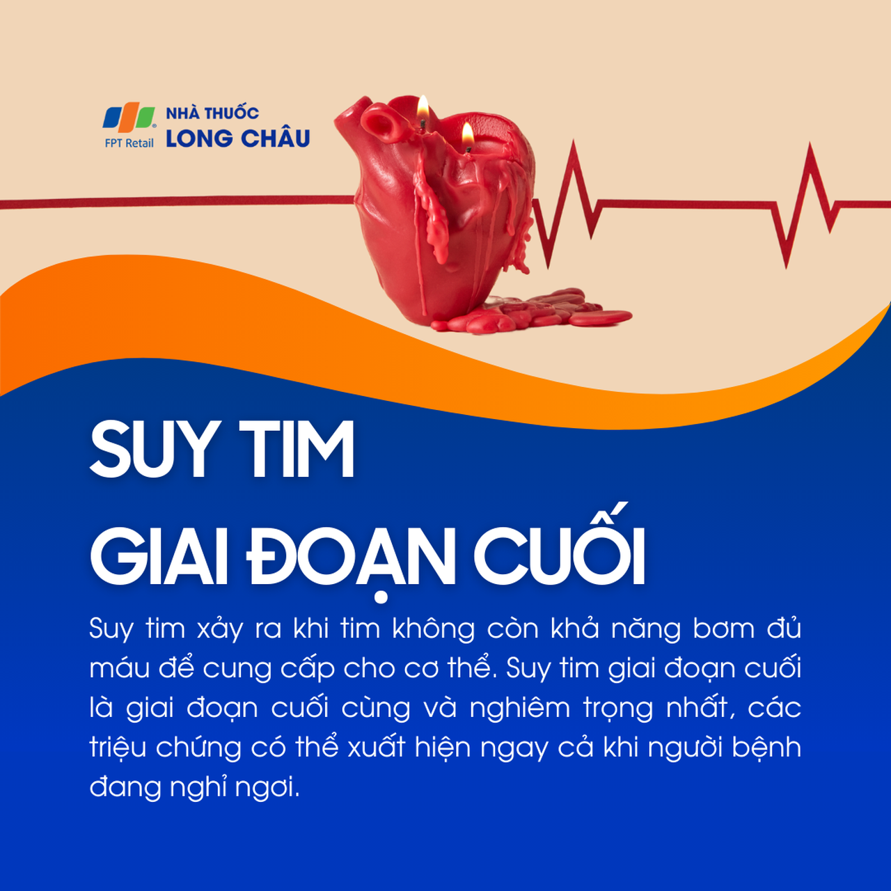 Suy tim giai đoạn cuối 1