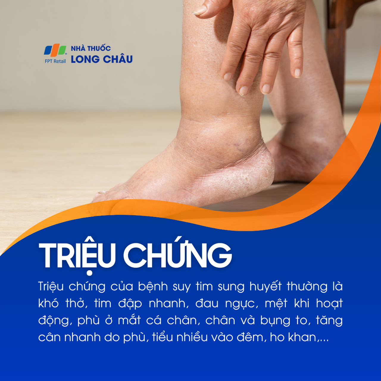 Suy tim sung huyết 2