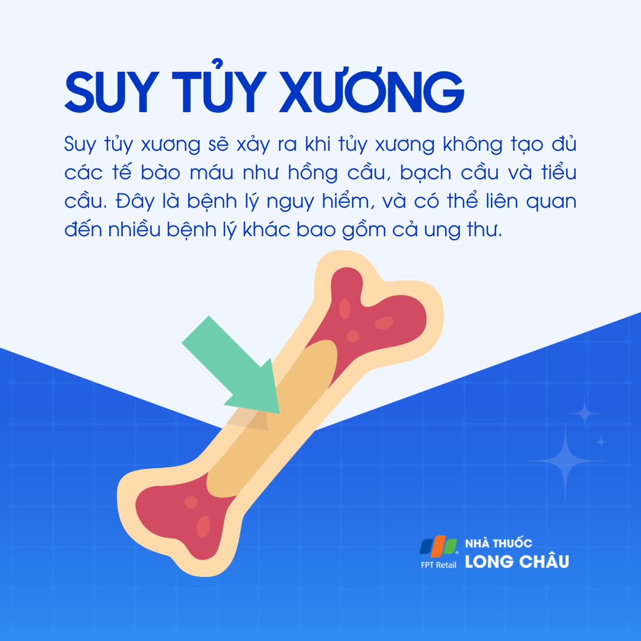 Suy tủy xương 1