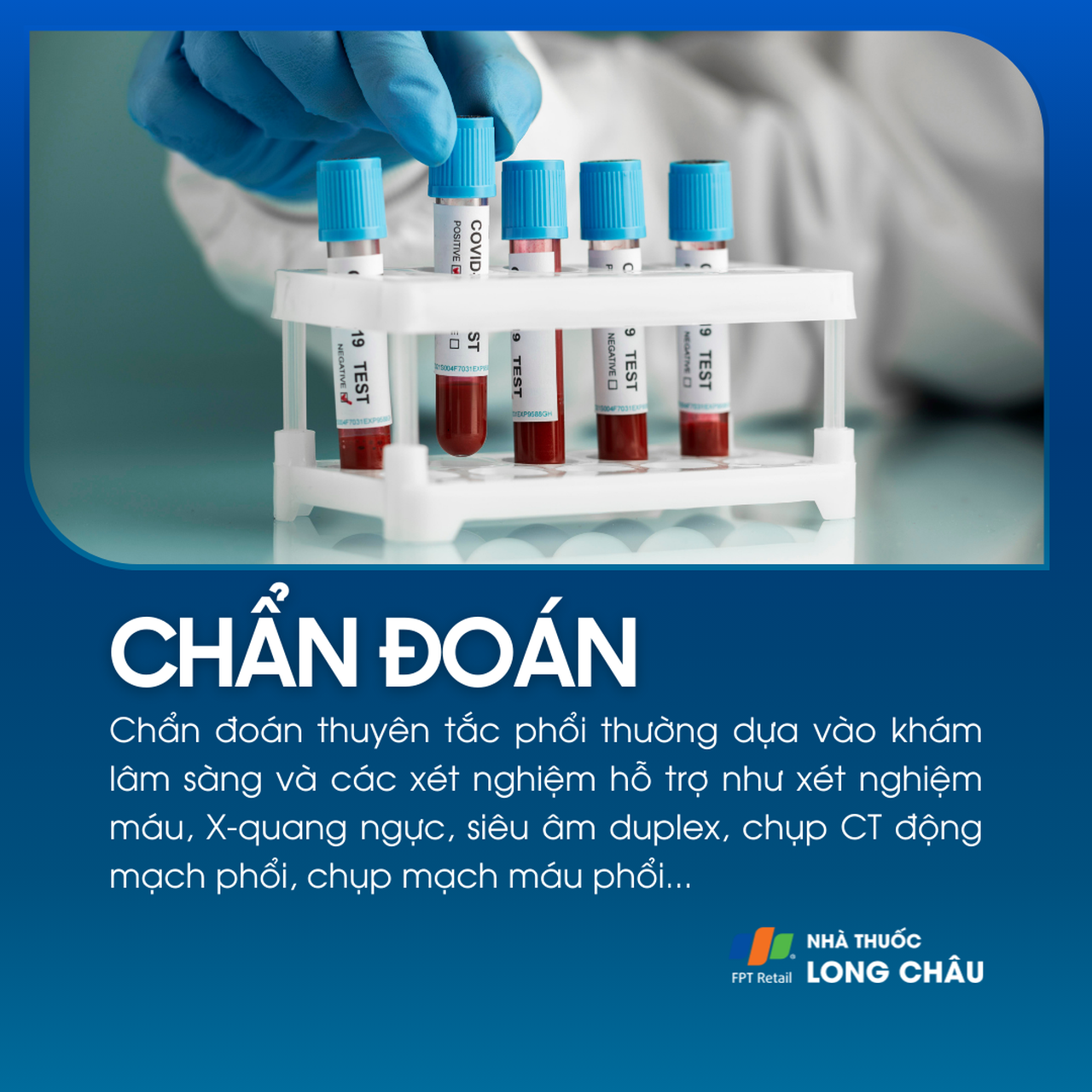 Tắc động mạch phổi 5