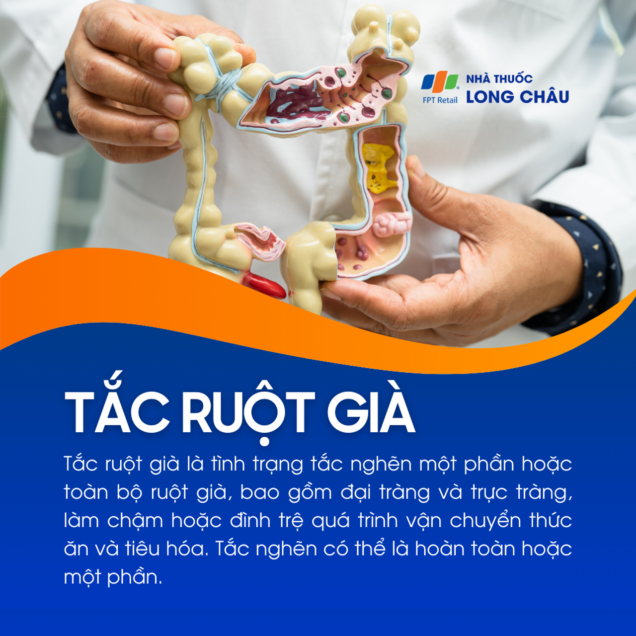 Tắc ruột già 1