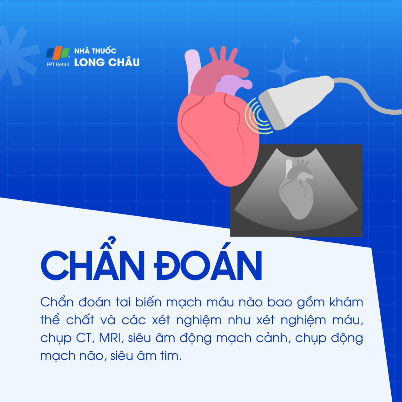 Tai biến mạch máu não 5