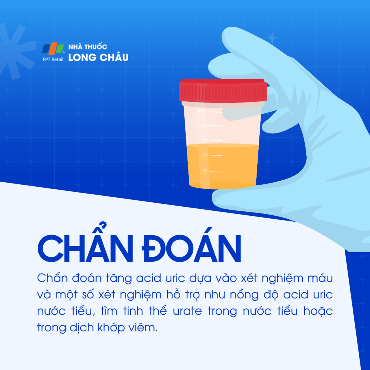 Tăng acid uric máu 5