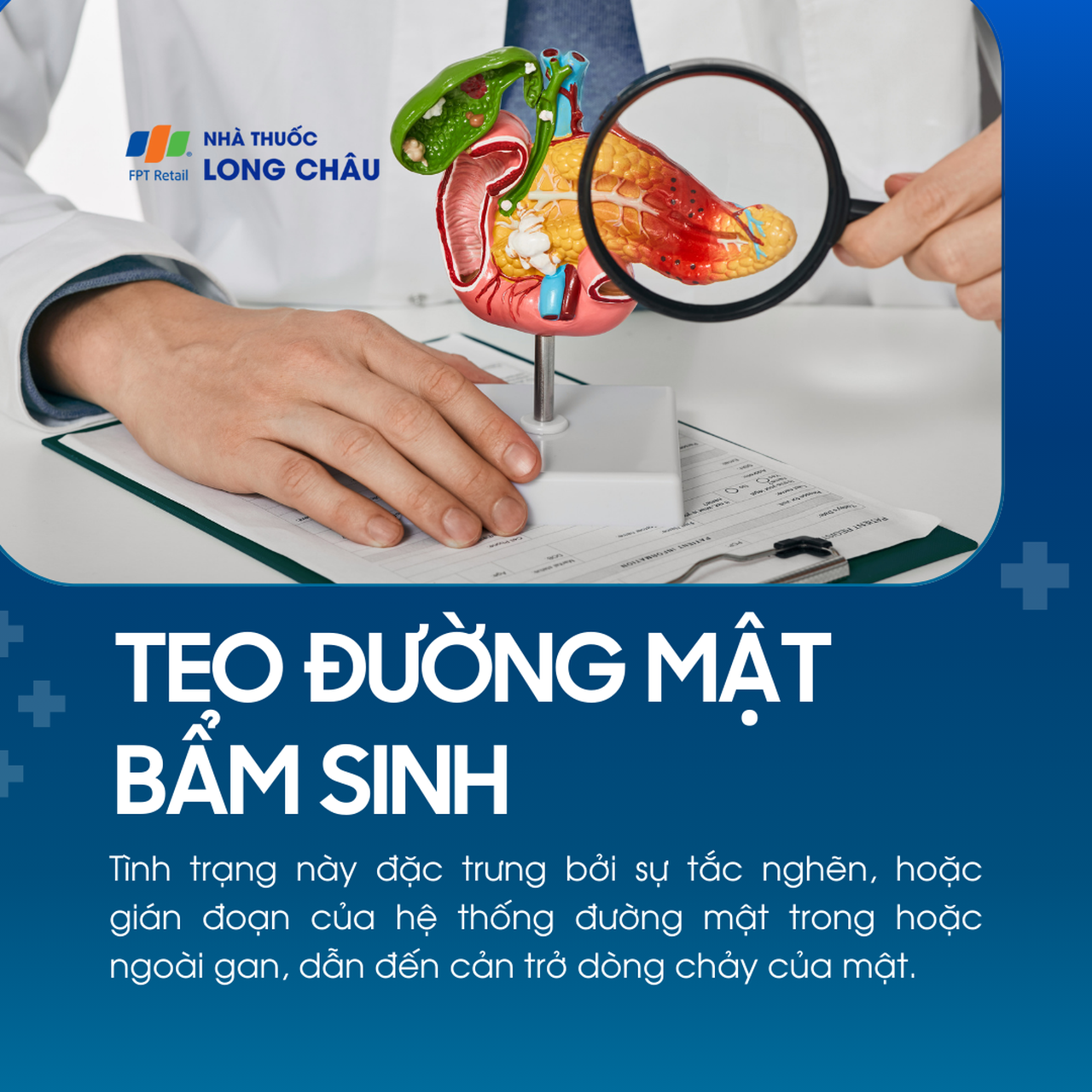 Teo đường mật bẩm sinh 1