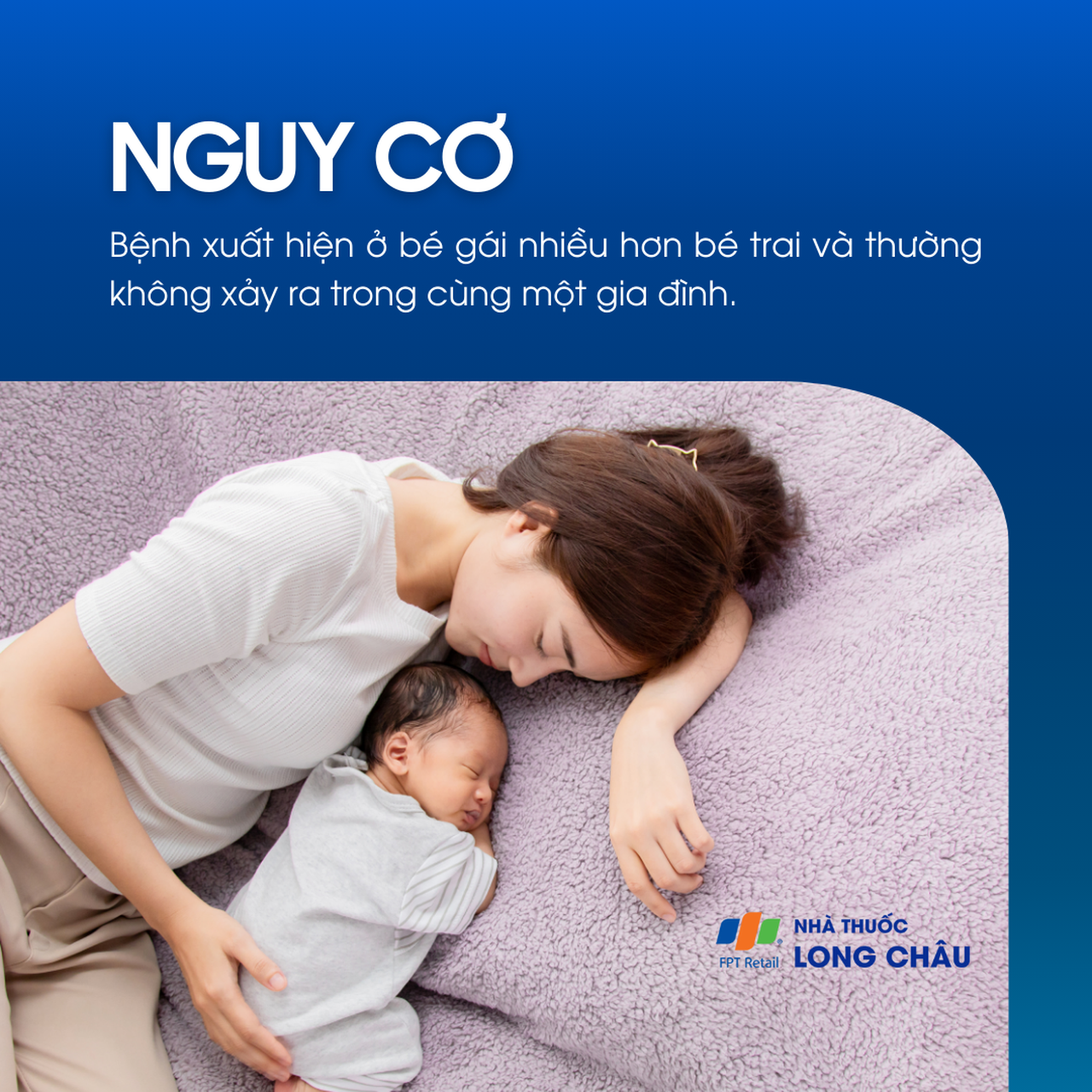 Teo đường mật bẩm sinh 4