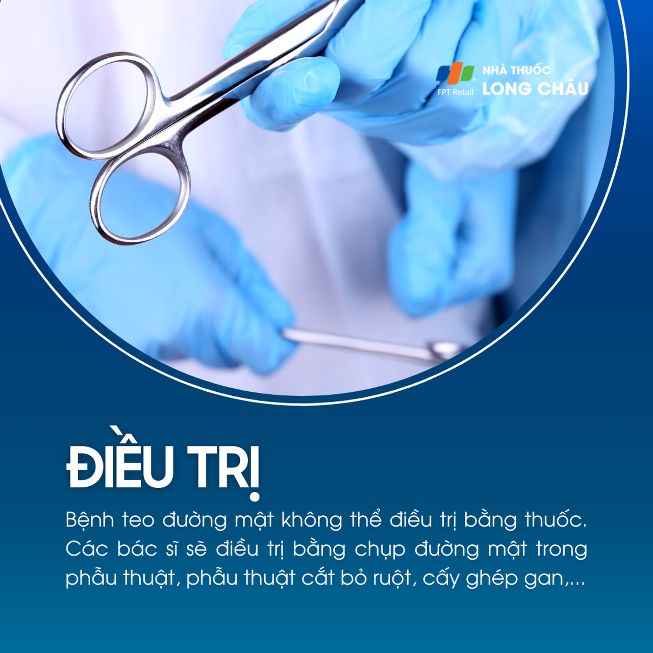 Teo đường mật bẩm sinh 6