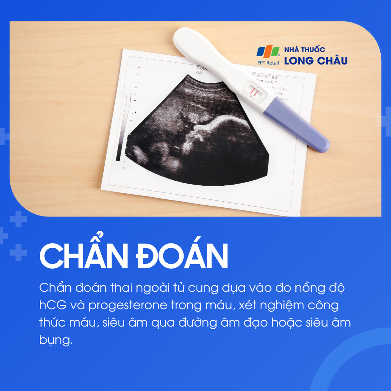 Thai ngoài tử cung 5