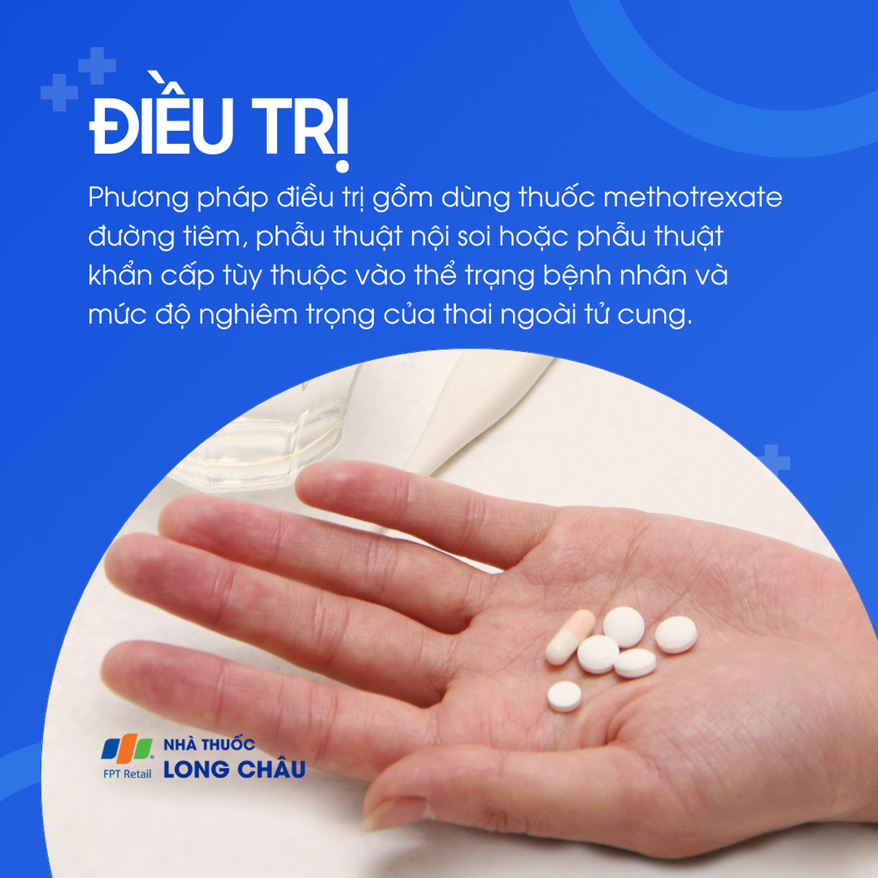 Thai ngoài tử cung 6