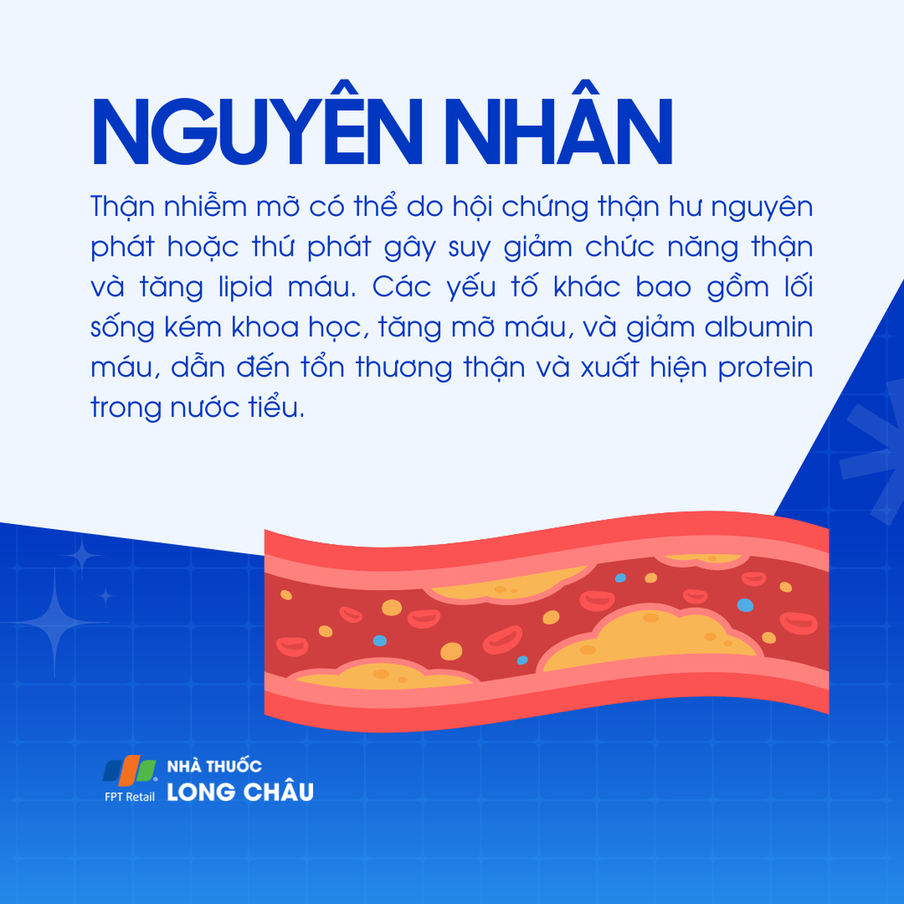 Thận nhiễm mỡ 3