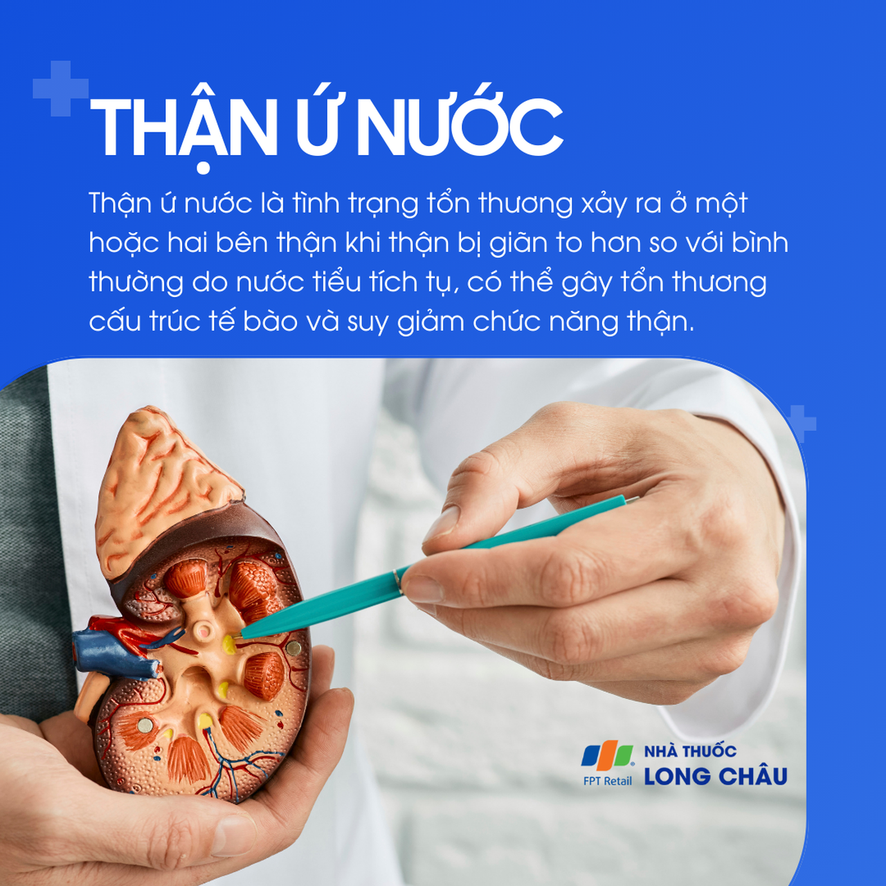Thận ứ nước 1