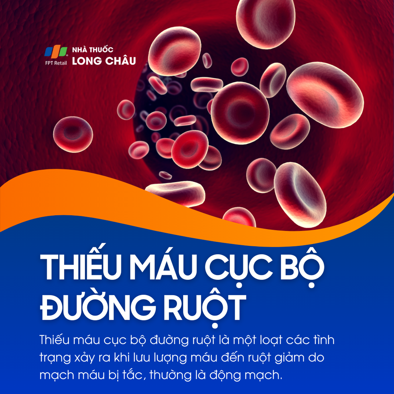 Thiếu máu cục bộ đường ruột 1