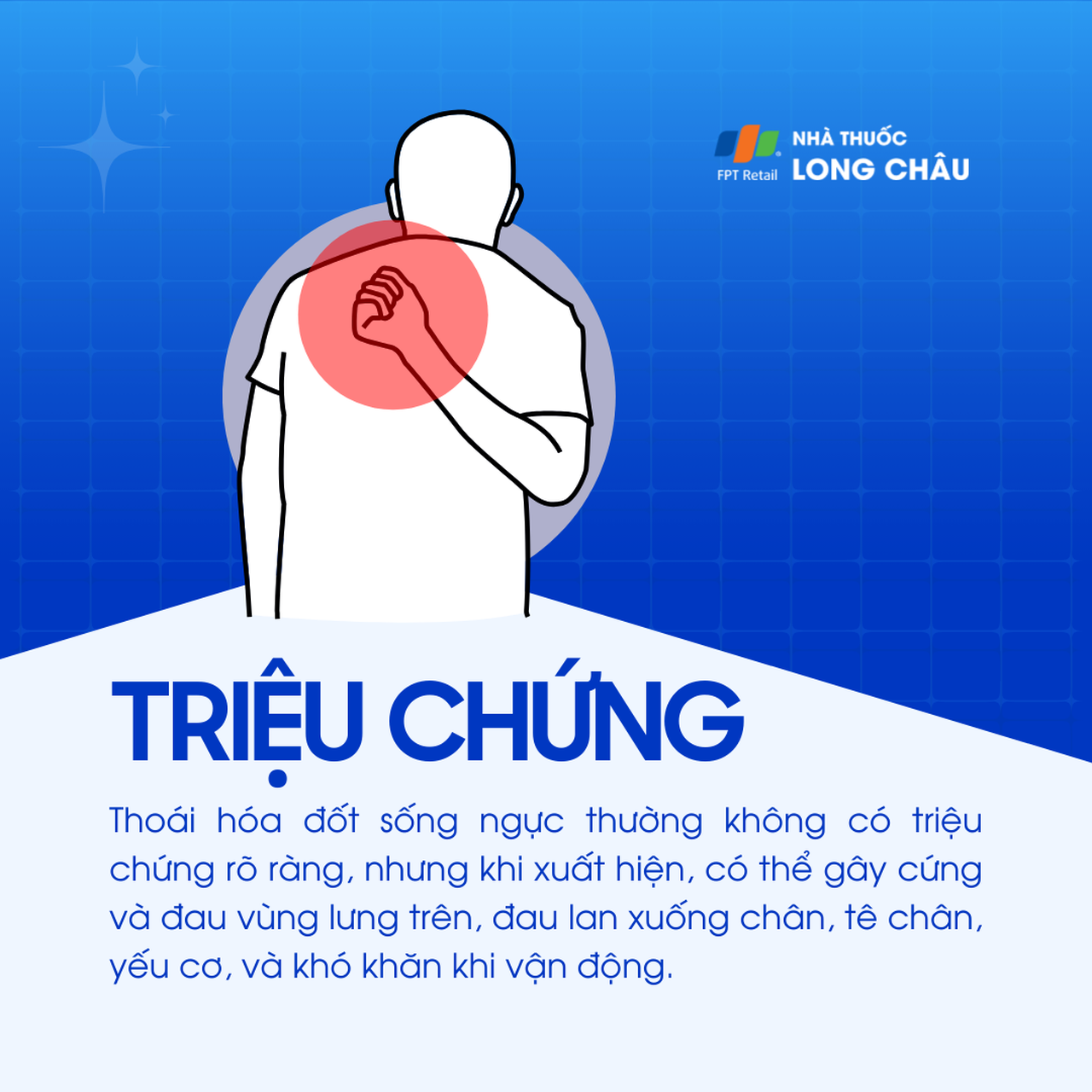 Thoái hóa đốt sống ngực 2