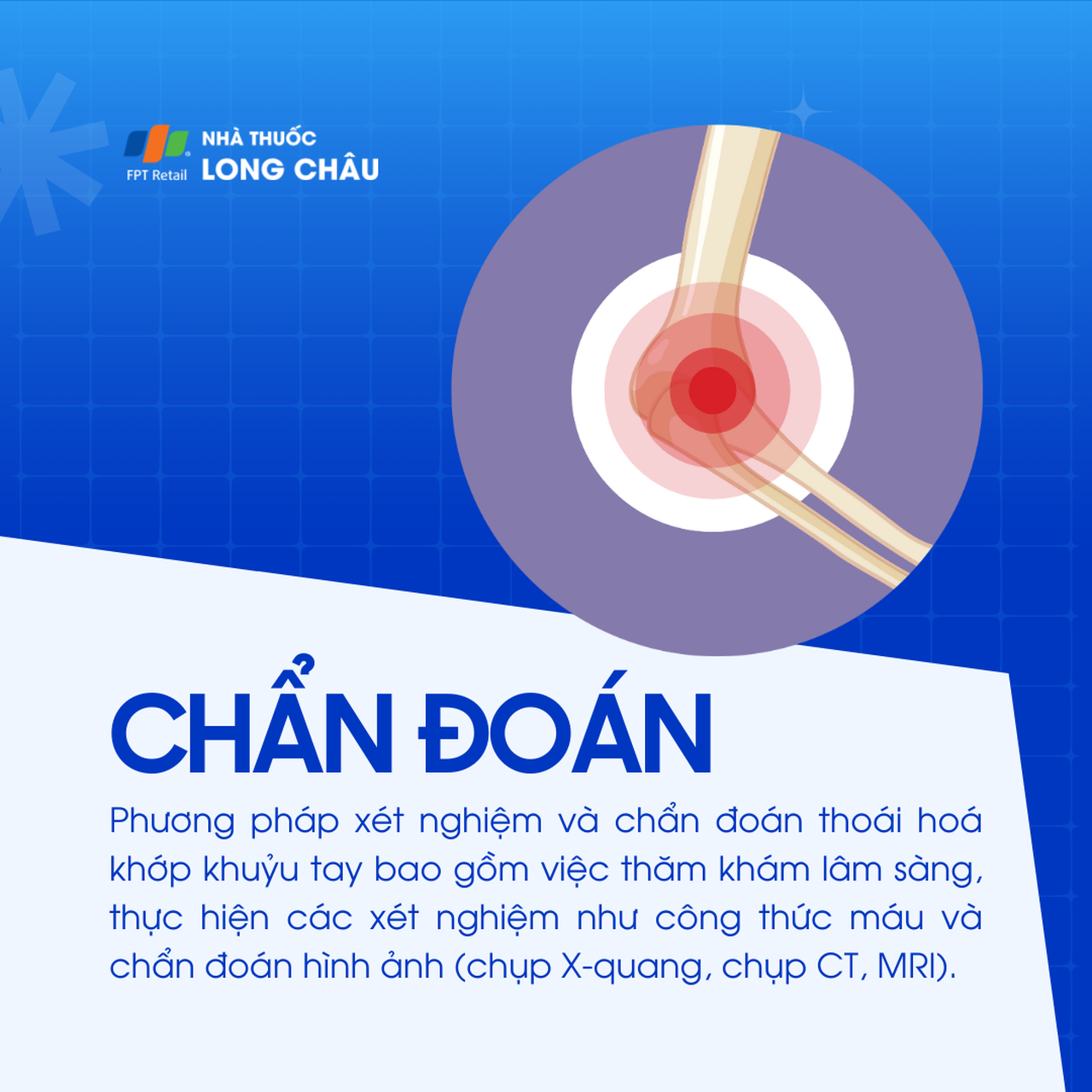 Thoái hóa khớp khuỷu tay 5