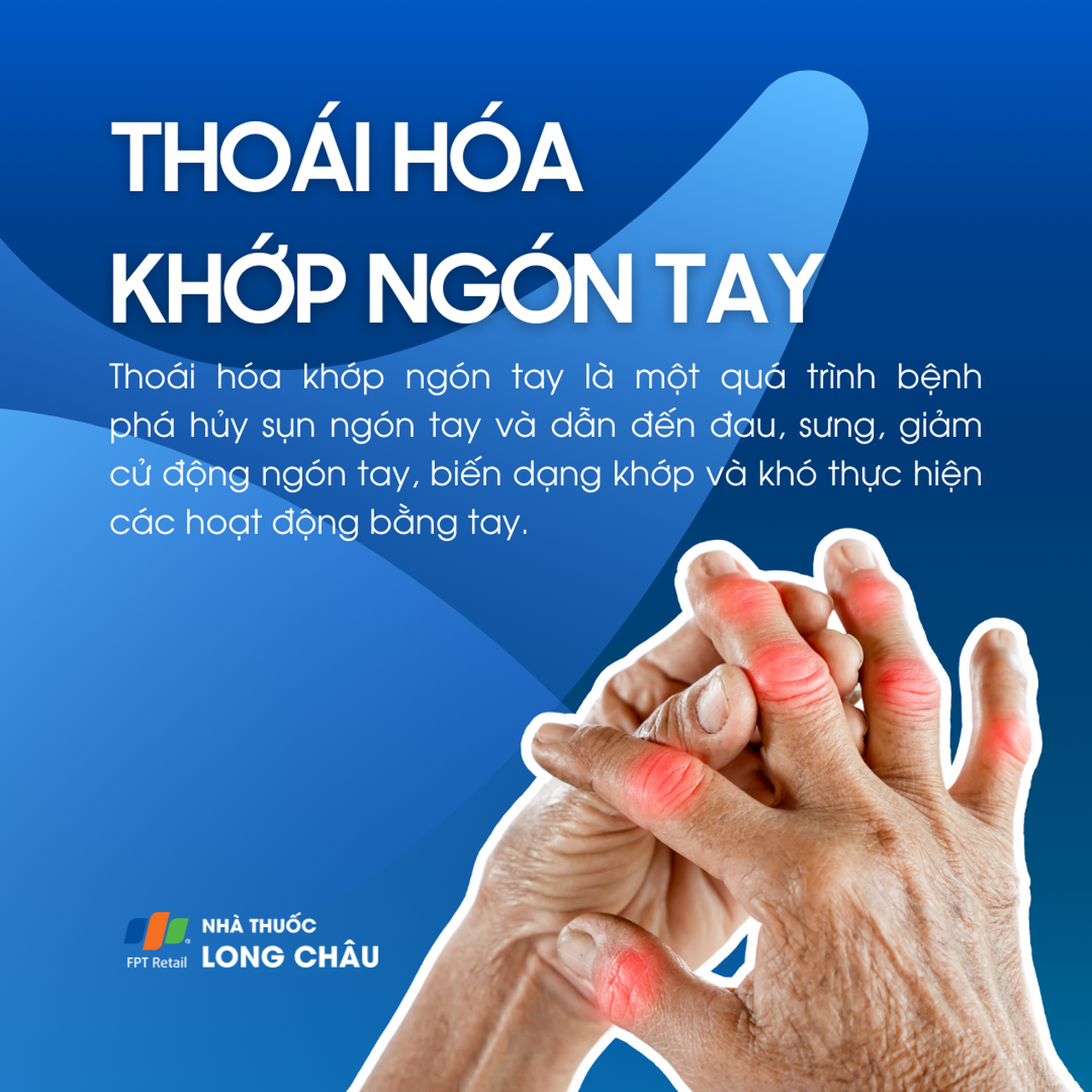 Thoái hóa khớp ngón tay 1
