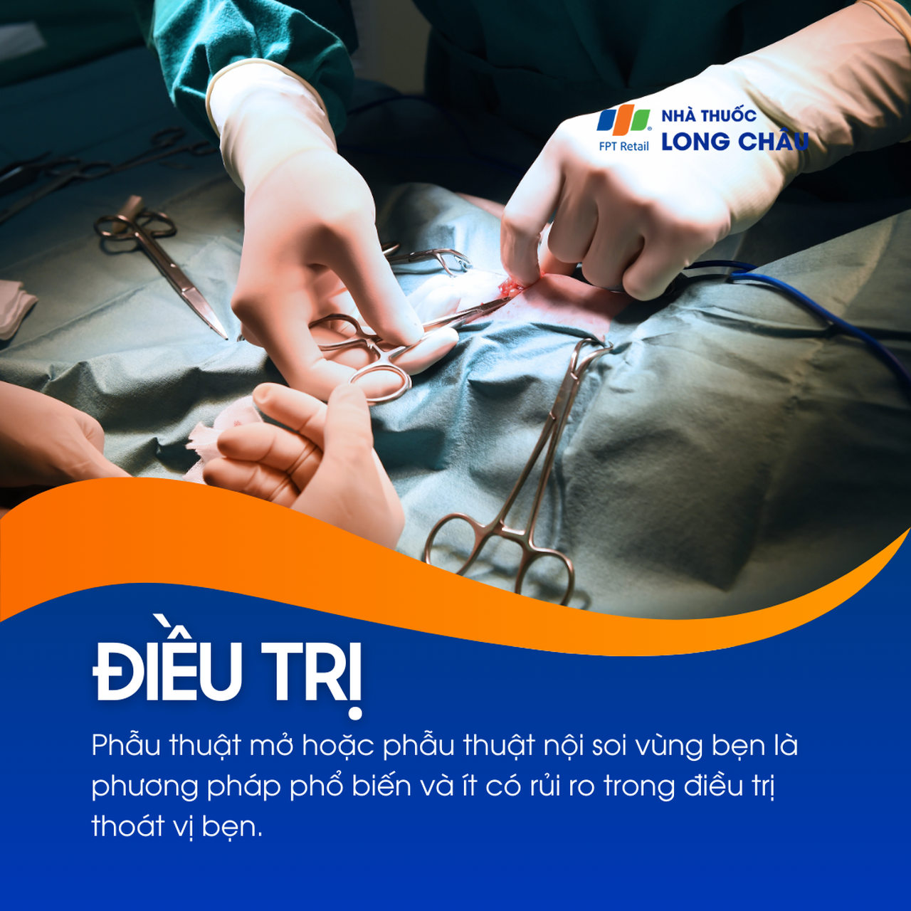 Thoát vị bẹn 6
