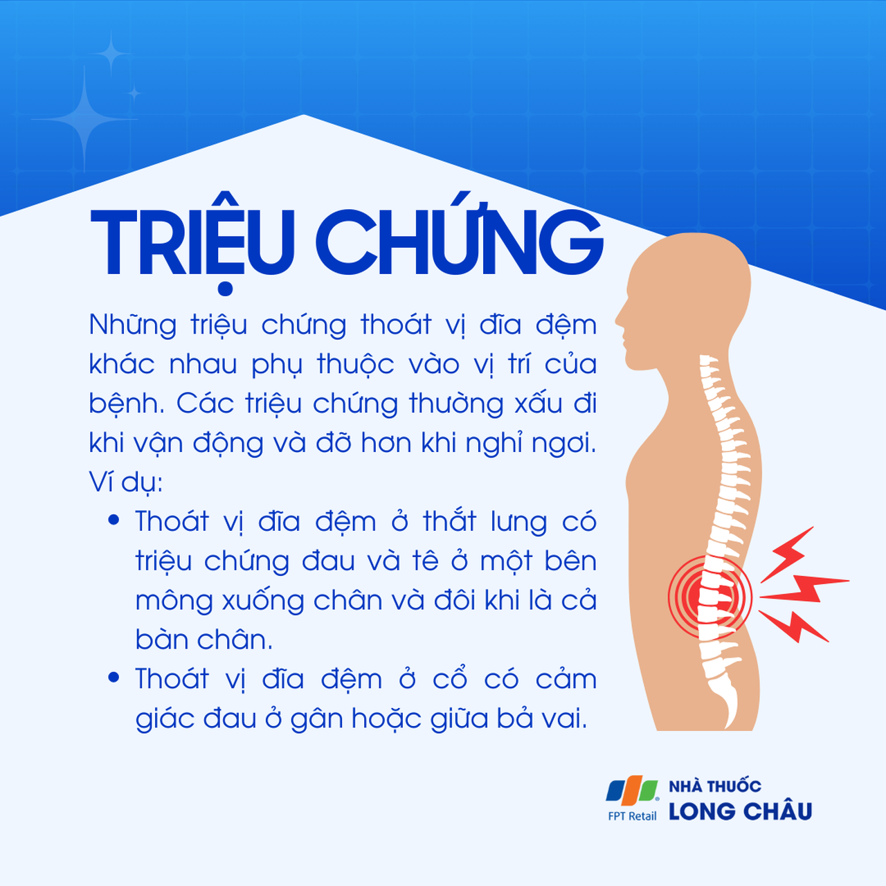 Triệu chứng thoát vị đĩa đệm – đau thắt lưng lan xuống chân hoặc đau cổ lan ra vai