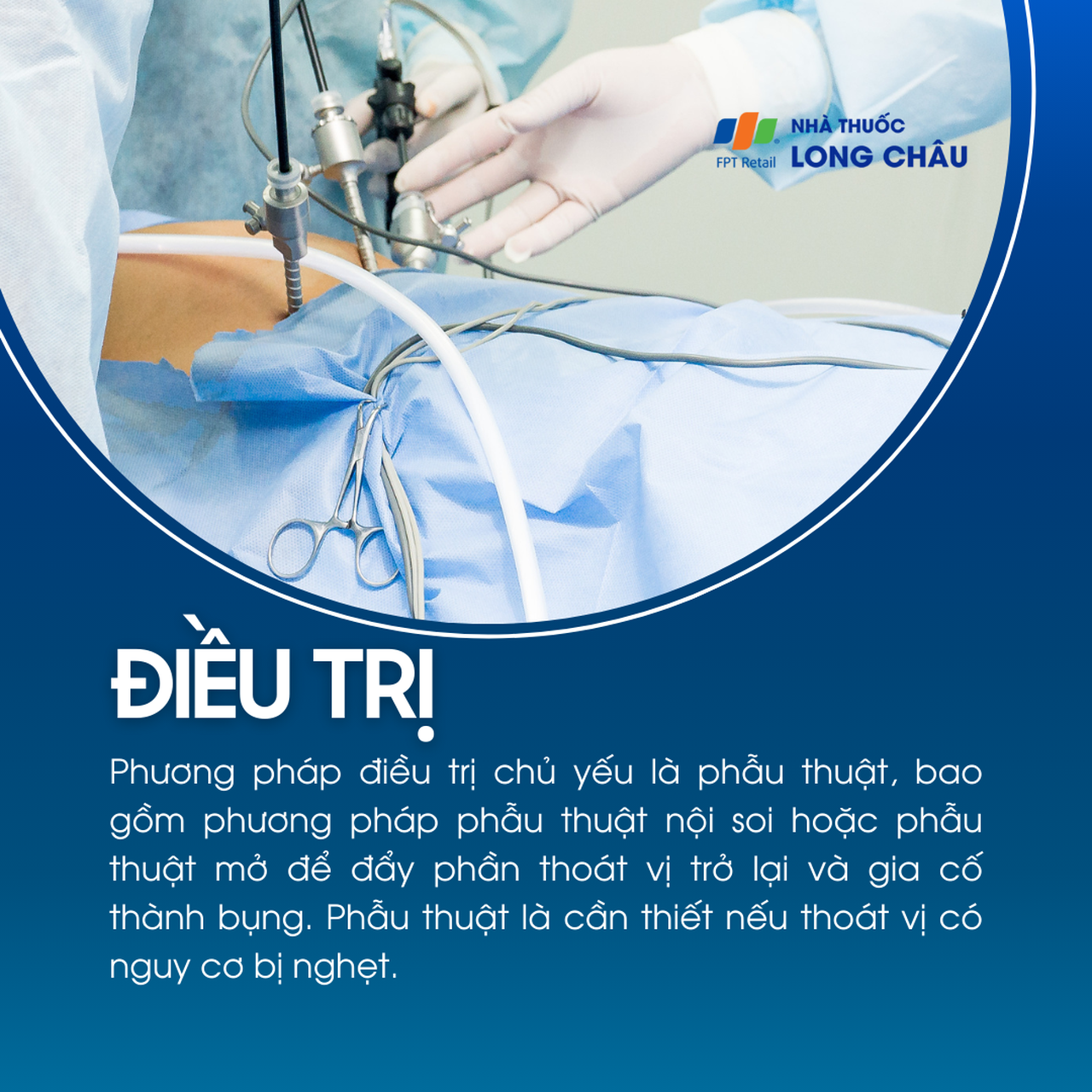 Thoái vị đùi 6