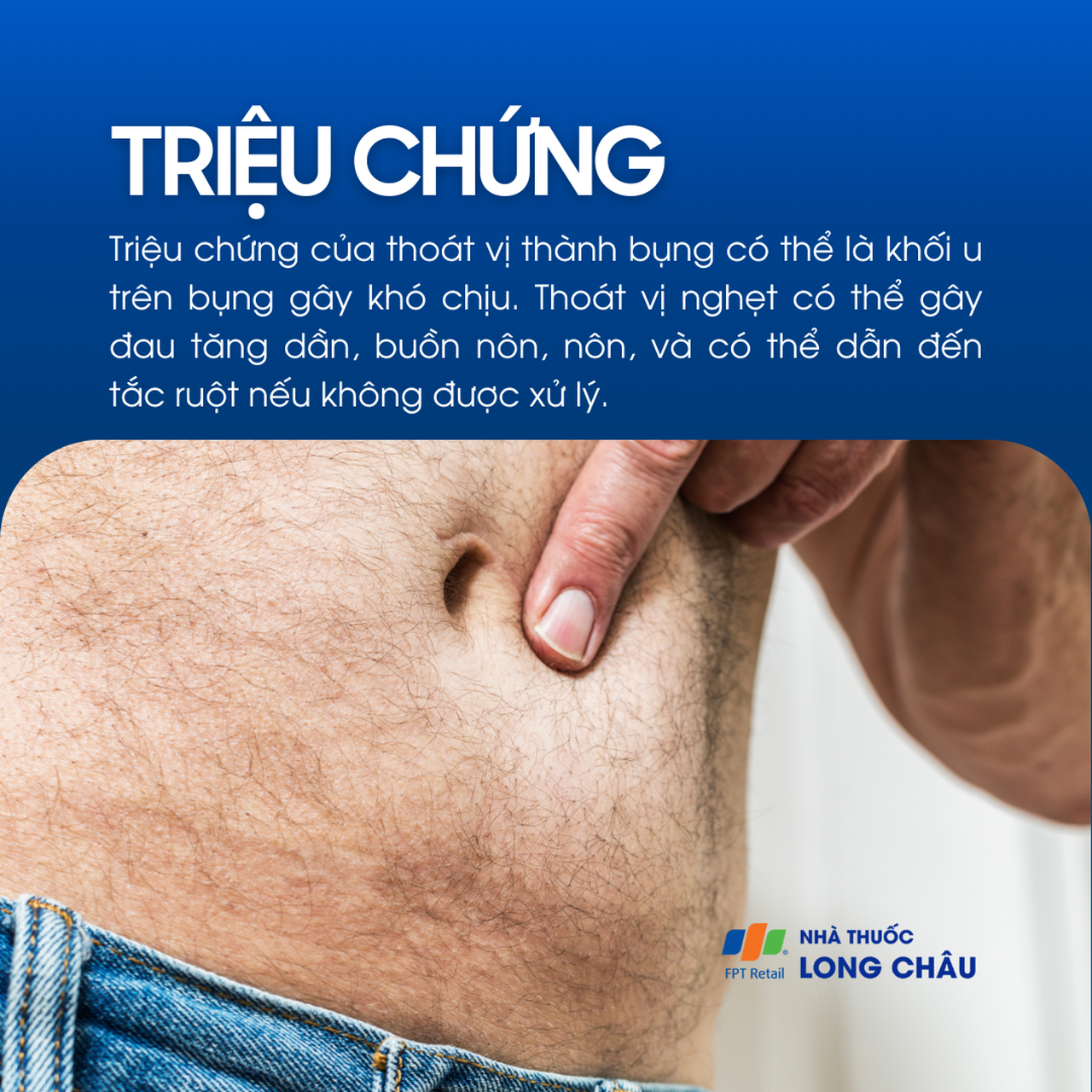 Thoát vị thành bụng 2