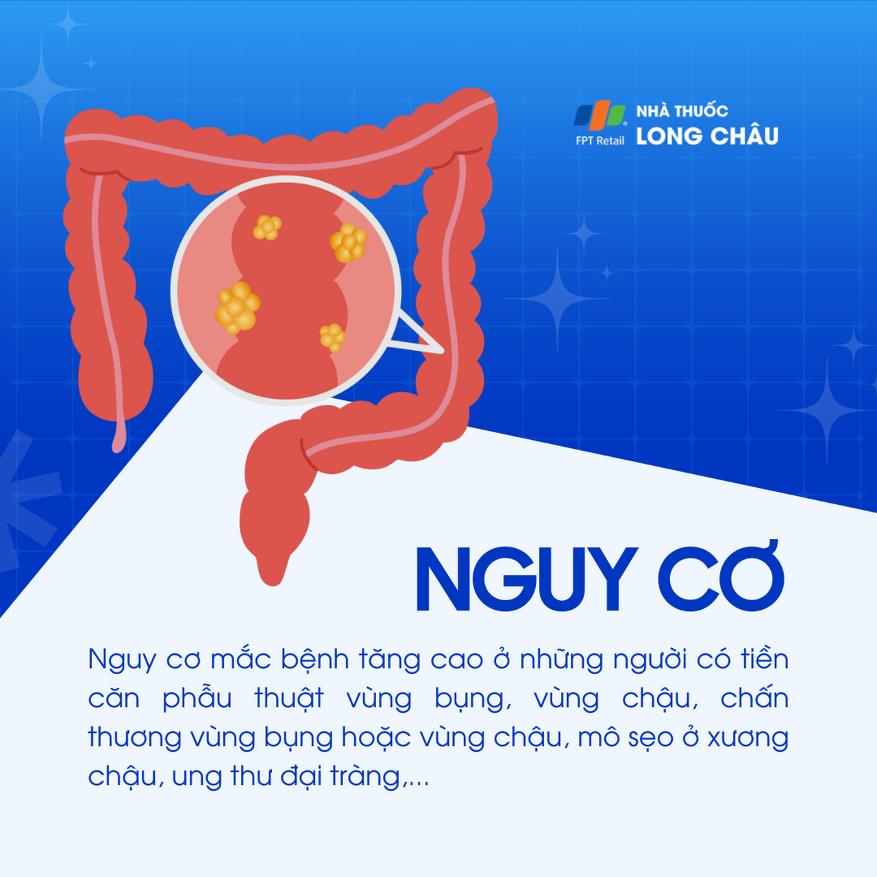 Thủng đại tràng 4