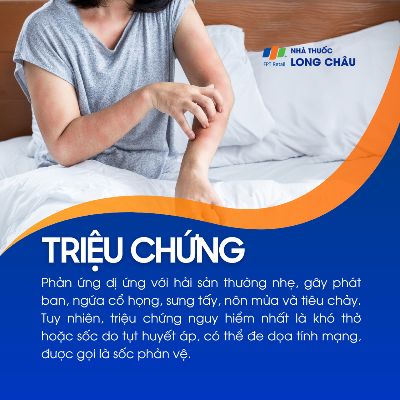 Dị ứng hải sản 2