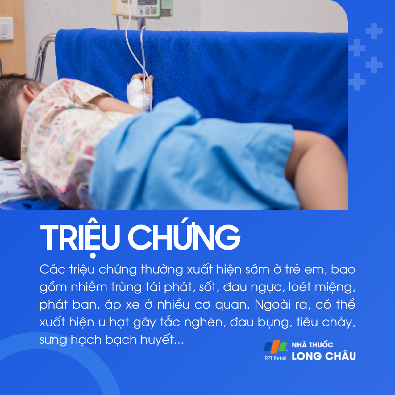 U hạt mạn tính 2