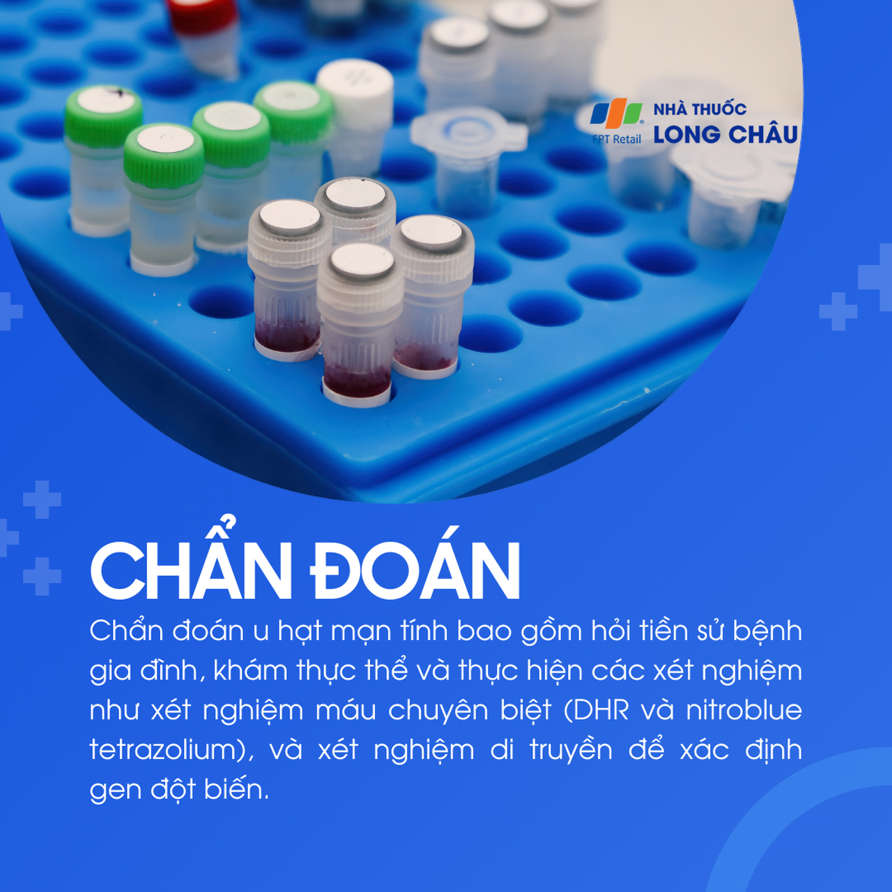 U hạt mạn tính 5