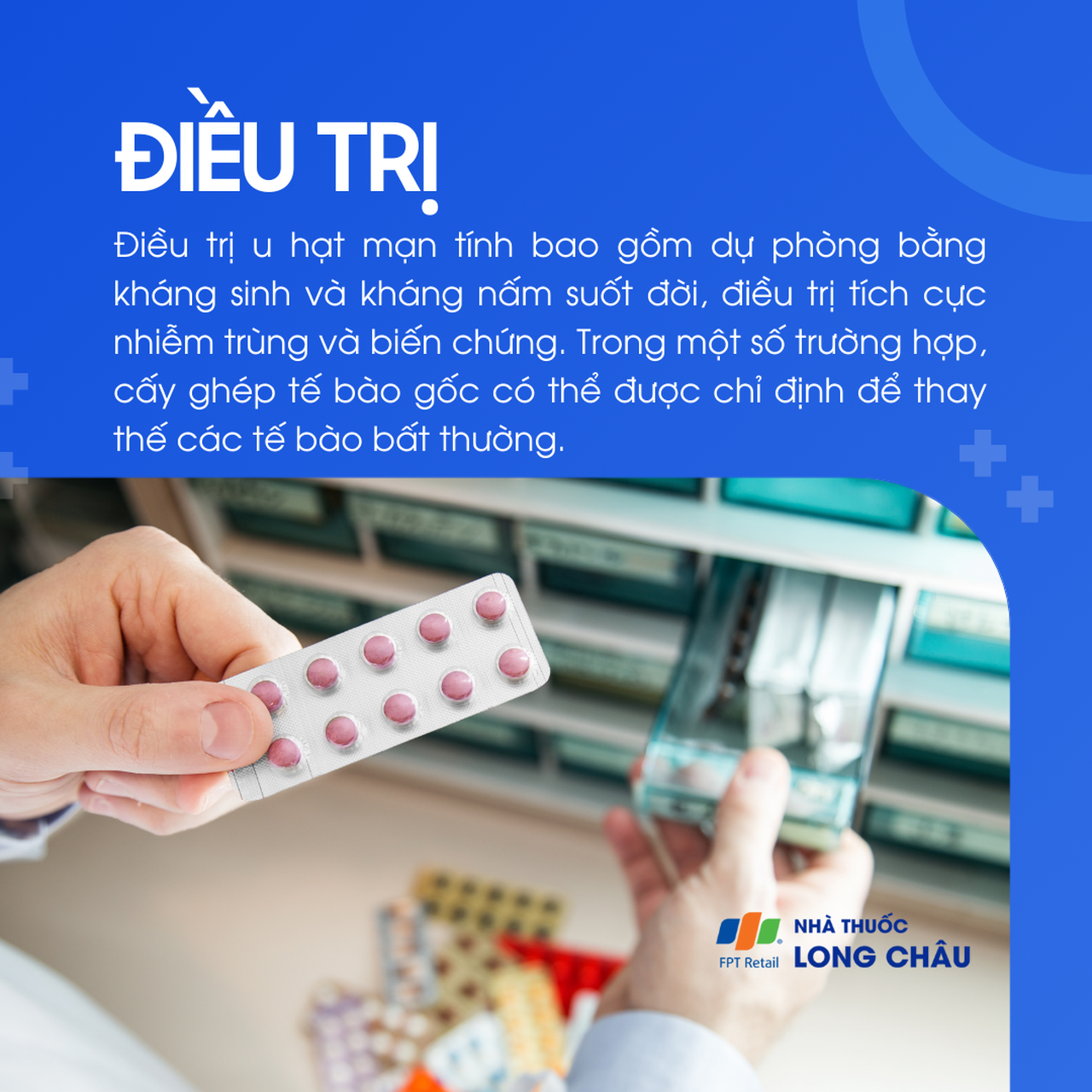 U hạt mạn tính 6