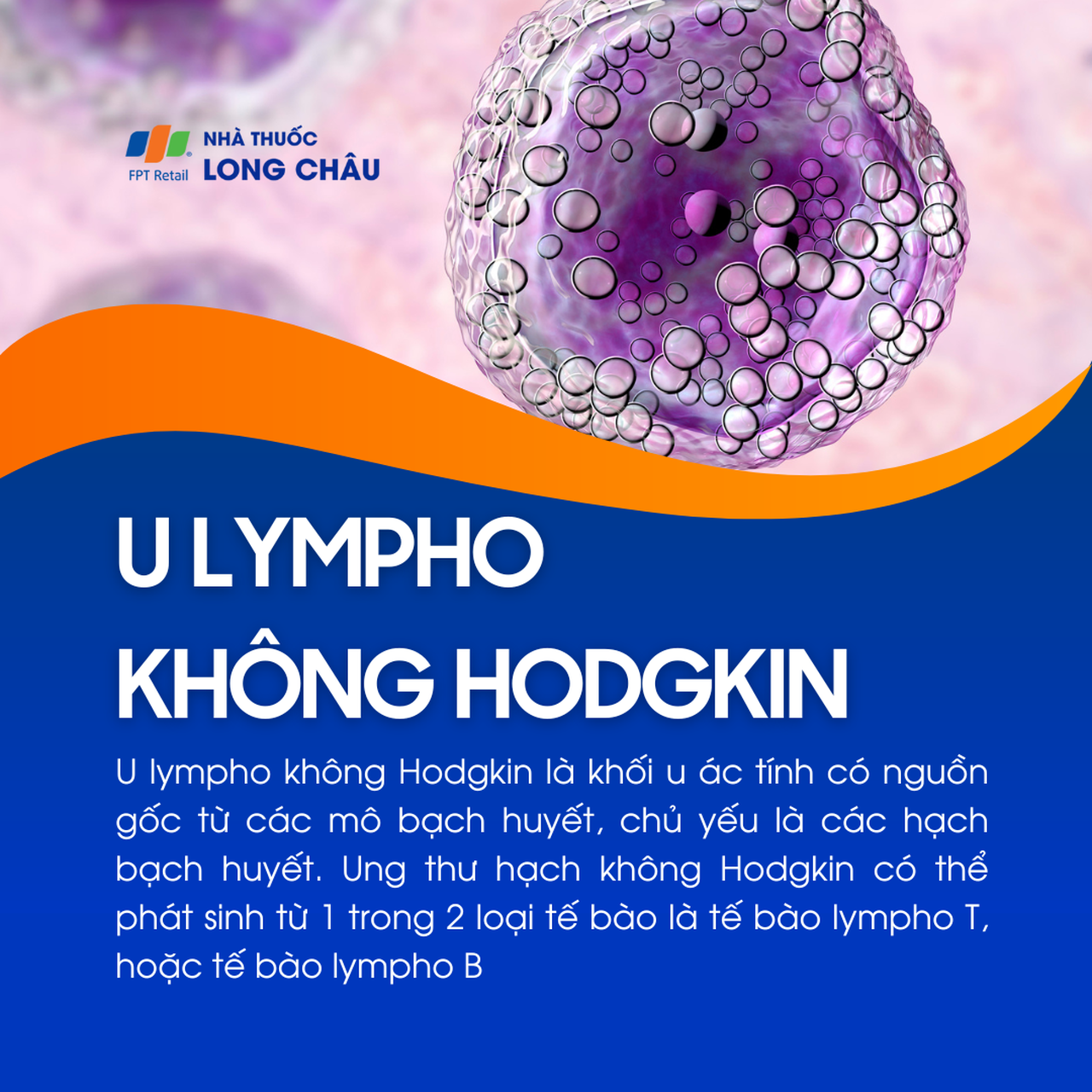 U lympho không Hodgkin 1