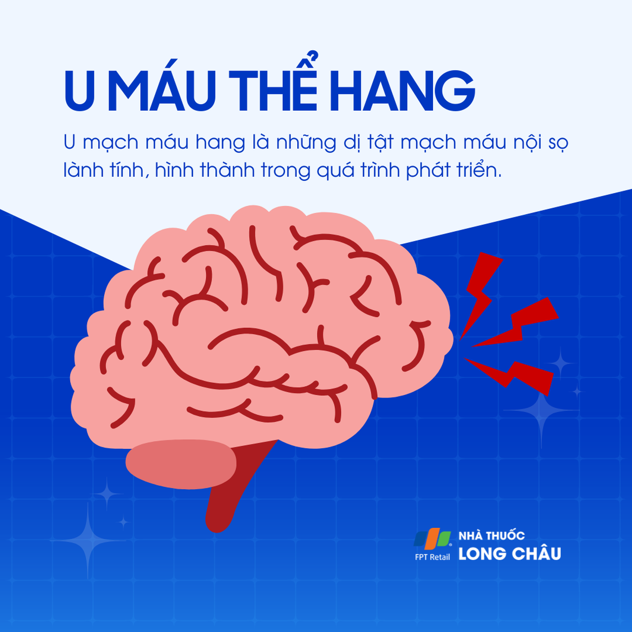 U máu thể hang 1