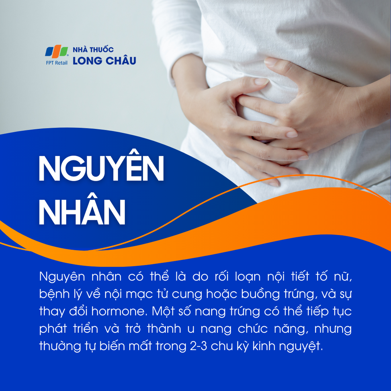 U nang buồng trứng 3