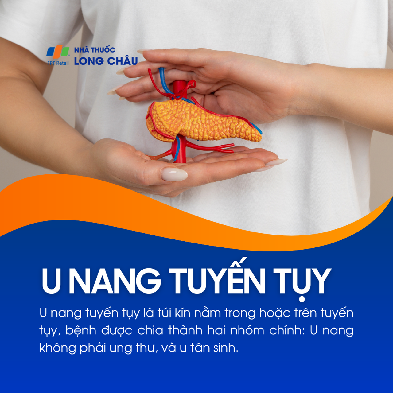 U nang tuyến tụy 1
