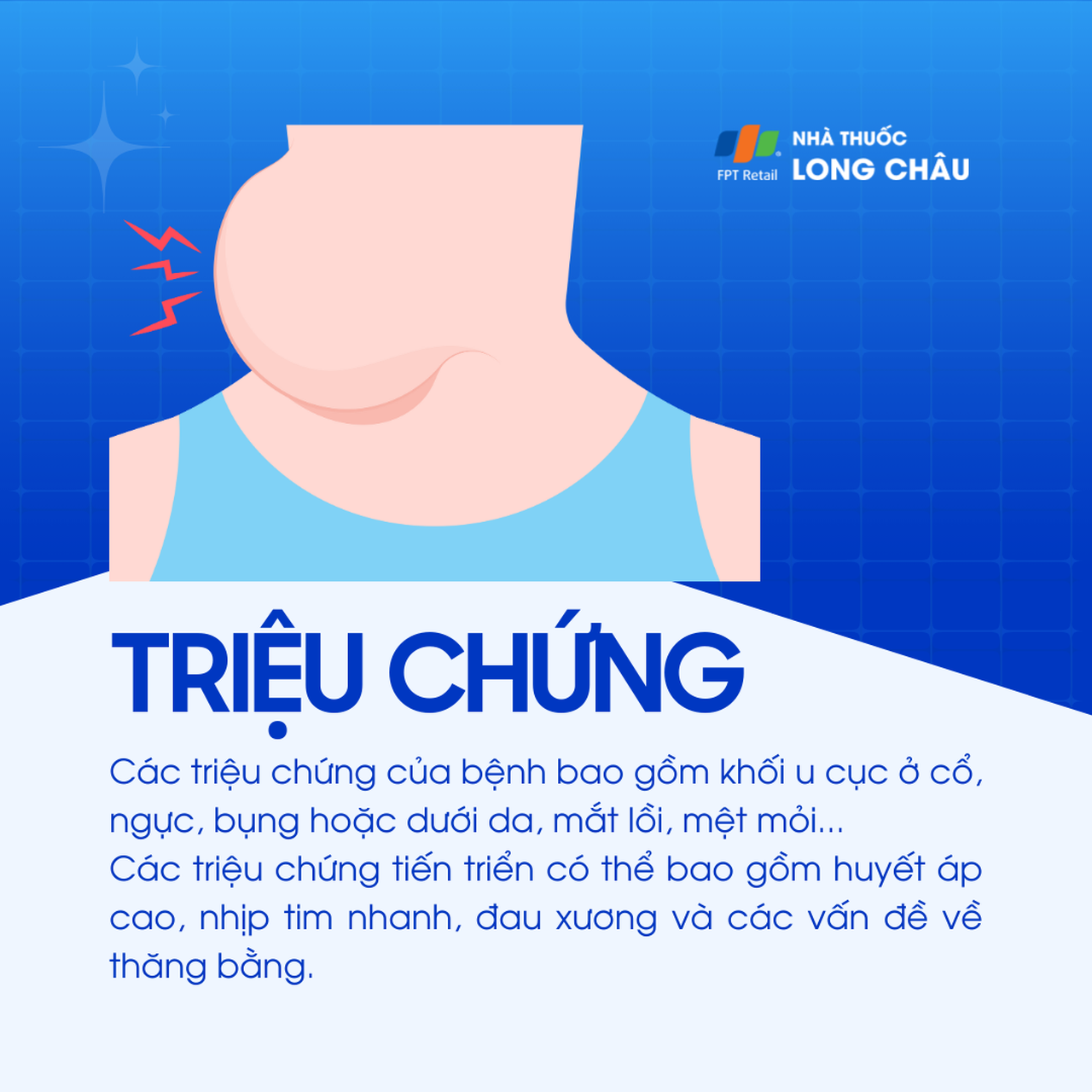 U nguyên bào thần kinh 2