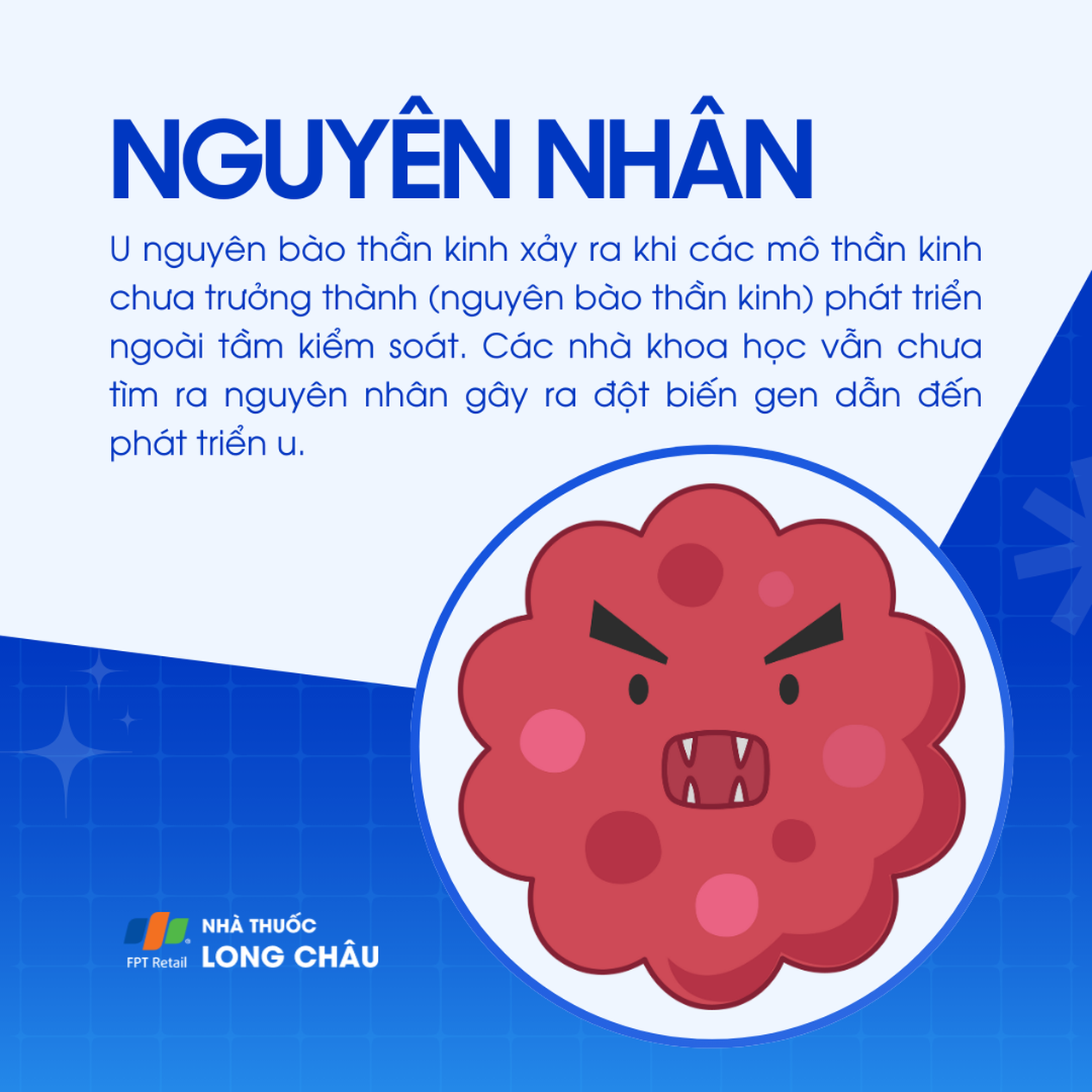 U nguyên bào thần kinh 3