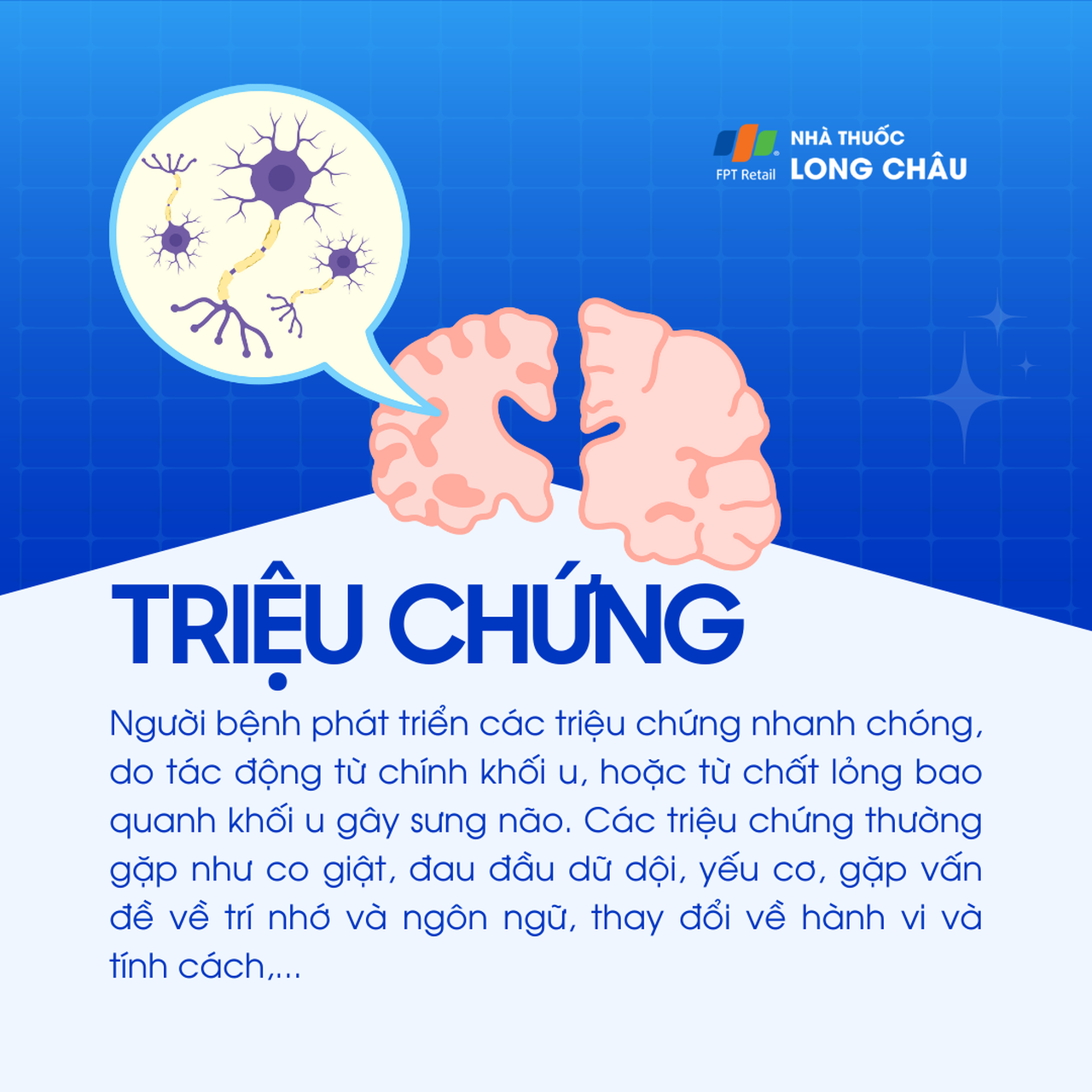 U nguyên bào thần kinh đệm 2