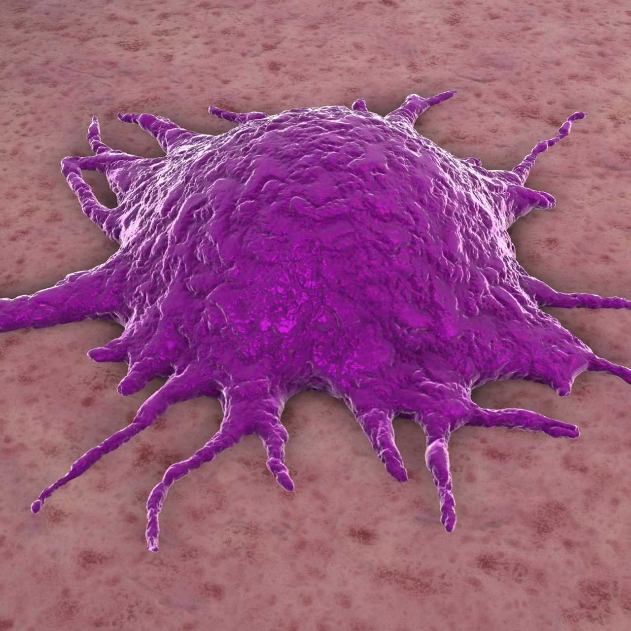 u nguyên bào xơ cơ viêm 2