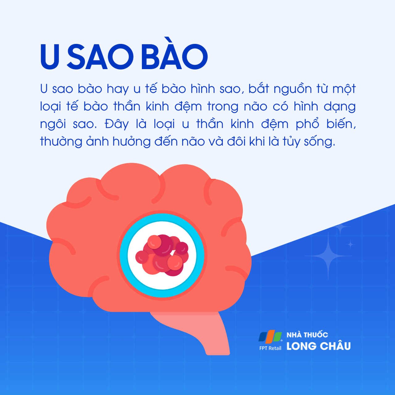 U sao bào 1